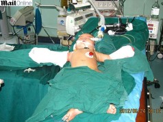 Avó Corta Mãos da Neta Sem Motivos na China