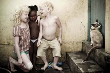 albinos-afrcanos-8