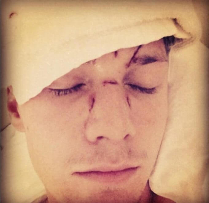 Barron Hilton