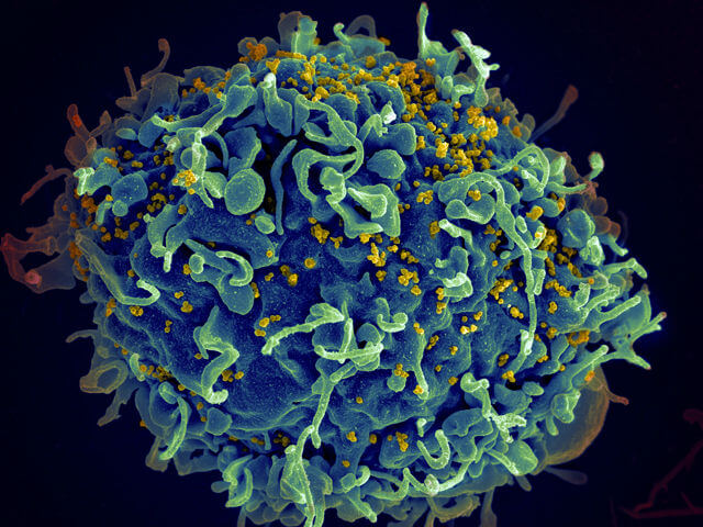 si-HIV
