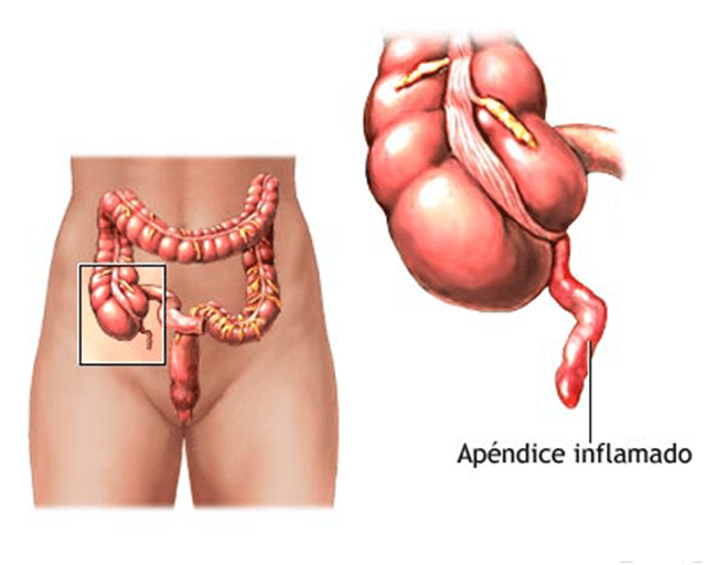 Apendice desenho