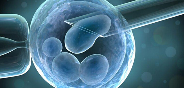 Fertilização In Vitro