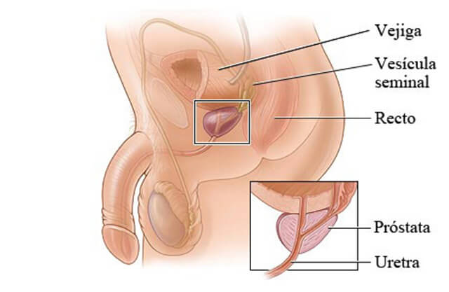 Prostata