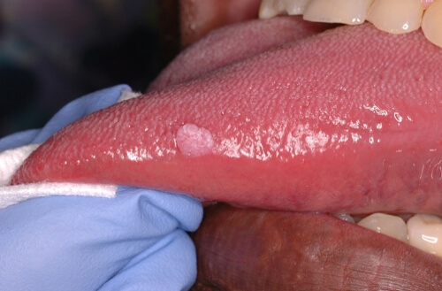 sexo-oral