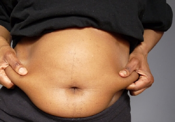 Actividade física para acabar com barriga pochete