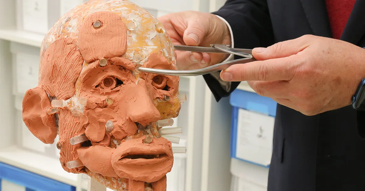 Reconstrução facial após traumatismo