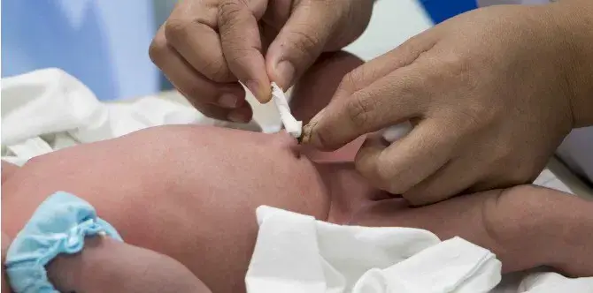 Mantenha o cordão limpo e seco