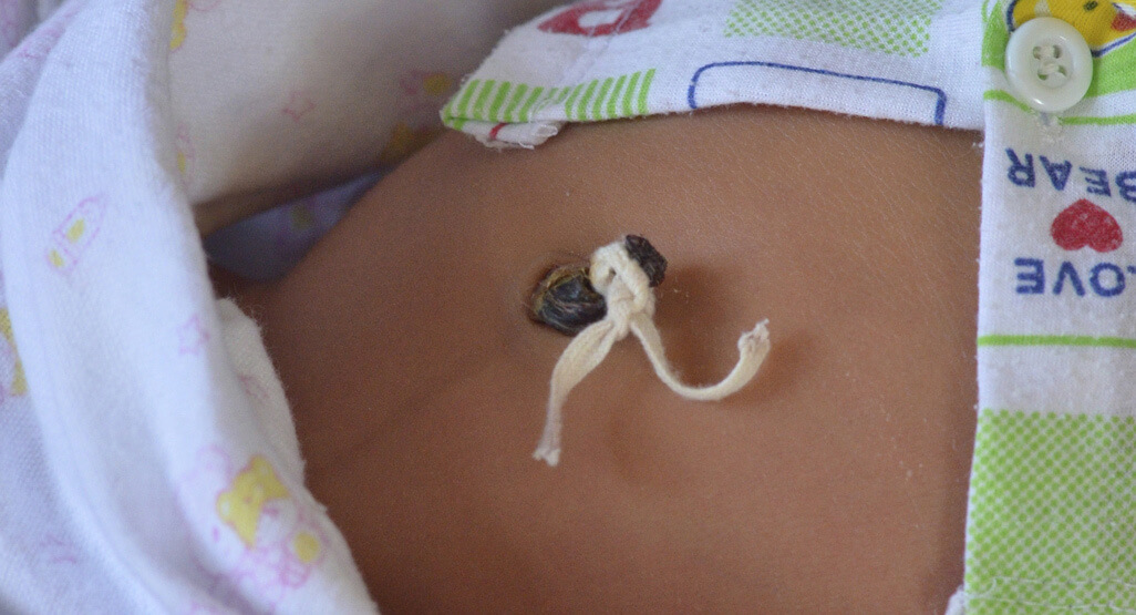 Não retire o cordão prematuramente