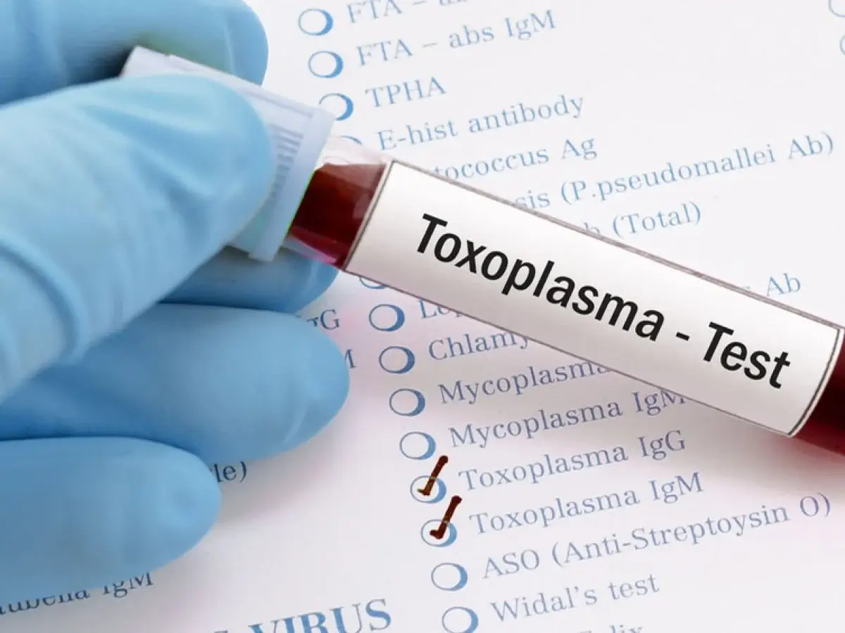 O que é a toxoplasmose?