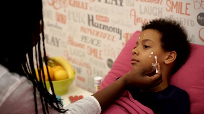 Mother applying cream onto skin of child with chickenpox.